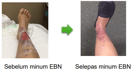 ProNest Minuman Sarang Burung No1 Malaysia