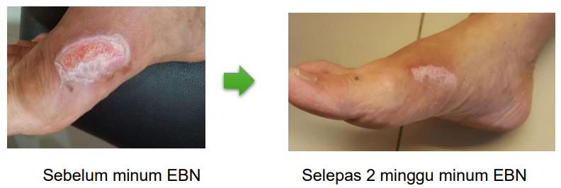 ProNest Minuman Sarang Burung No1 Malaysia