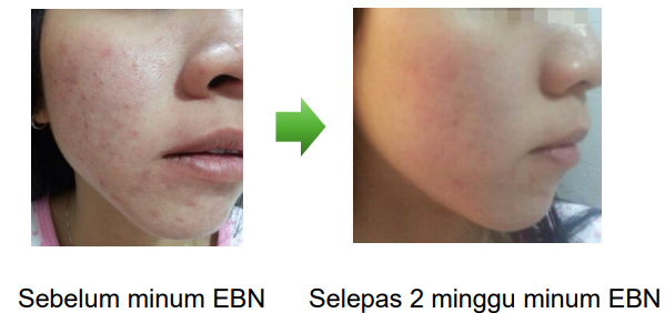 ProNest Minuman Sarang Burung No1 Malaysia